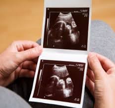 Pin On Fetal Development