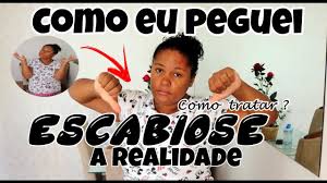 A fêmea desse aracnídeo, que só pode ser visto com um microscópio, atravessa a epiderme para viver, se alimentar e botar ovos. Estou Com Sarna Humana Escabiose Youtube