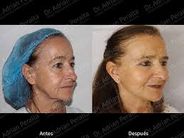 Dr. Adrián Peralta Jerezano