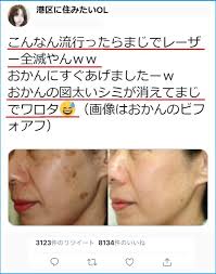 現役皮膚科医が勧める 顔のシミ消し術 暴露で絶賛の嵐 2週間で驚きの効果が lucky life ほくろ除去クリーム 顔のシミ 皮膚科