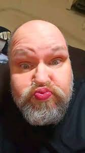 Anyone here in Waynesville also undergoing breast cancer treatment? Looking  for some community. Maybe a chatting/walking group at the park? I've had  surgery and chemo and am headed into radiation soon. Thanks