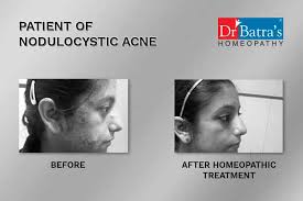 Road, tamil nadu, chennai, 600018, india. Dr Batra S Healthcare Dermatologists Book Appointment Online Dermatologists In Budharaja Sambalpur Justdial
