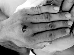 Image result for Hand Injury