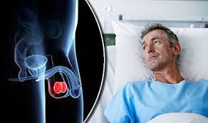 He is not one of those who tell everything about themselves in the first meeting itself. Cancer Symptoms Diarrhoea And Constipation Could Be Signs Of Bowel Condition Express Co Uk