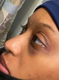 Paterson police brutality: Details vary in telling of 3 alleged cases