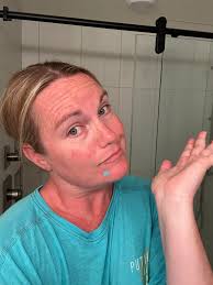 Help my sister!!! What can she use for those stubborn pimples?