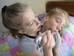 Abigail abby loraine hensel and brittany britty lee hensel (born march 7, 1990) are dicephalic parapagus twins, meaning that they are conjoined twins of whom each has a separate head, but whose bodies are joined. What Are Famous Conjoined Twins Abby And Brittany Hensel Up To Today Monagiza