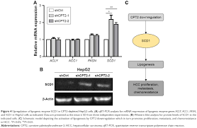 Downregulation Of Cpt2 Promotes Tumorigenesis And Chemoresistance To C Ott