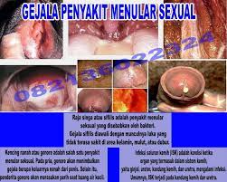 Jual obat cytotec asli tablet di apotik k24. Inilah Antibiotik Nama Dan Harga Obat Sipilis Raja Singa Herbal Ampuh Di Apotik Kimia Farma Elissabeth