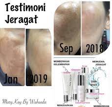 So sebab itu, kesannya kita tak nampak dalam masa jangka pendek. Set Mary Kay Memutihkan Jeragat