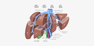 Savesave liver pathophysiology and schematic diagram for later. Pld Liver Resection Polycystic Liver Disease Adpld Liver Lobes Anatomy Free Transparent Png Download Pngkey