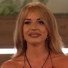 I thought my lips looked great until I left Love Island villa', says Faye  Winter