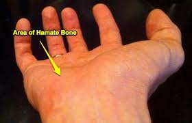 Image result for Hamate Bone