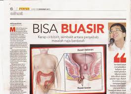 Check spelling or type a new query. Petua Kecutkan Buasir Posts Facebook