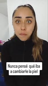 Estoy muy contenta con como le mejoró la piel. No pensé qué iba a cambiar  tanto.