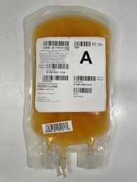 Image result for Plasma Transfusion