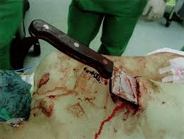 How long it will take to heal a wounded foot. Penetrating Trauma Amboss
