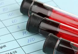 A blood test can detect signs of cancer four years before symptoms appear, an exciting new study led by chinese researchers found. Pioneering Blood Test To Detect Cancer Developed By Imperial Researcher Imperial News Imperial College London