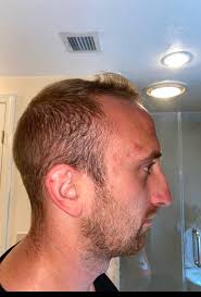 First HT, any thoughts or suggestions