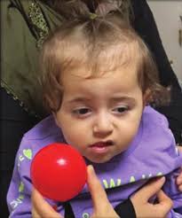 TURKISH OURNAL OF OPHTHALMOLOGY