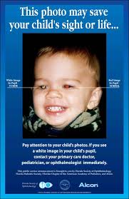 Pin By Kayla Lott On Nursing Eye Health Pediatric Ophthalmology Eye Facts
