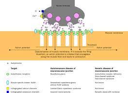 Myasthenia Gravis The Lancet