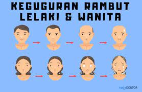 Apa sebenarnya punca rambut gugur? 6 Punca Rambut Gugur Hello Doktor