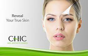 Niumee concept esthetique · 3. Chemical Peels Chic Med Aesthetic Clinics