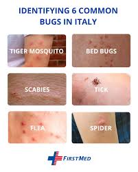 Image result for scabies bite