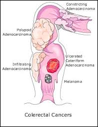 Pin On Moringa