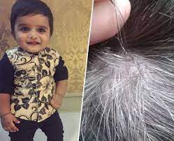 If you notice white hair at an early age, it's likely that your ancestors also had graying or white hair at an early age. Effective Home Remedies To Treat Premature Greying In Kids