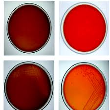 Congo red binds to curliated whole cells, does not inhibit growth, and can be used to comparatively congo red and e. Shigella Salmonella Agar And Congo Red Binding Assay