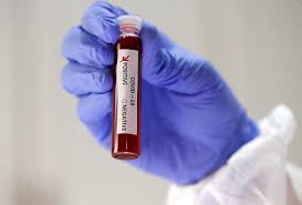 Coronavirus Testing Capacity Triples At Indus Hospital