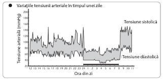 După o săptămână de tratament și regim fără sare tensiunea a scăzut la 110/60(11 cu 6).fizic. Tensiometru Mecanic Aneroid Cu Stetoscop Little Doctor Ld 100 Manseta 25 36 Cm