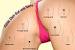 Itching After Shaving Private Area