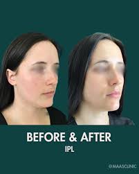 Corey S. Maas MD, FACS