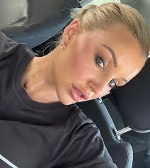 🚨 ‼️ 🔔 Last Call for Lip Filler Model Appointments! Thank you to everyone  who has already taken advantage of this fantastic opportunity to achieve  beautiful, rejuvenated lips at incredibly discounted prices.