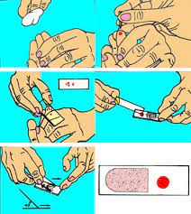 Microscopic Tests Malaria Site