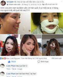 Ngoài ra, cô còn được tôn vinh là nữ nghệ sĩ solo quốc tế tại lễ trao giải brits 2020 danh giá của nước anh. Co Gai Ham Ho Ä'Æ°á»£c Hang Nghin NgÆ°á»i Quan Tam Khi Tung áº£nh Sau Tháº©m Má»¹ Ngoi Sao