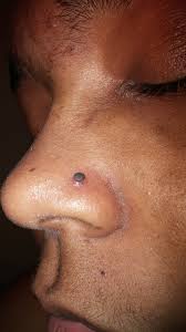 Nose piercing is a beautiful way to stand out in the crown but there is a list of things to take into now, let's have a closer look at the available nose piercing options so that you are able to in most cases, it does not require the piercing of cartilage itself so that it heals faster and is less painful. Parity Will My Nose Piercing Close Up Overnight Up To 79 Off
