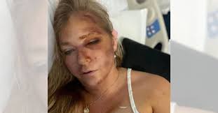 Caso Epstein: “Não sou suicida”, disse vítima antes de aparecer morta