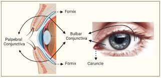 Image result for conjunctival melanoma