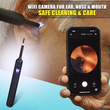 Buy Wi-Fi Camera for Ear, Nose & Mouth ...