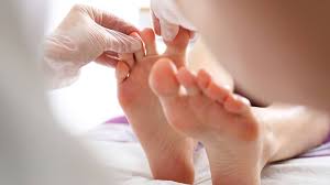 Wash your feet and toes with warm, soapy water and a mild soap. Caring For An Infected Or Ingrown Toenail