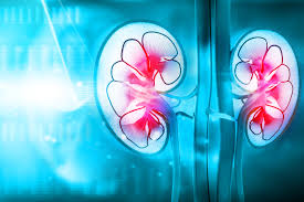Crohn S Disease May Contribute To Developing Kidney Stones