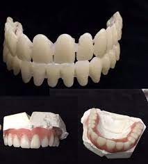 Diy Kit Denture Resin Teeth Upper Lower Best Denture Kit Etsy Denture Dental Impressions Partial Dentures