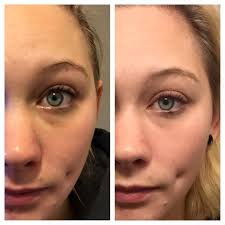 Kyle and Victoria Buxton Nerium International