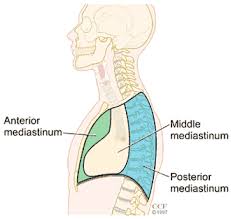 Check spelling or type a new query. Dangers Of A Tooth Abscess Part 3 Mediastinitis