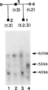 Maybe you would like to learn more about one of these? Human Chromosome An Overview Sciencedirect Topics