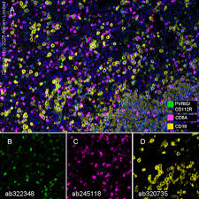 Anti-CD8 alpha antibody [EPR22483-288] 20 ul size (ab245118)